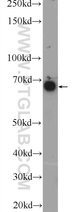 KIAA0907 Rabbit anti-Human, Mouse, Polyclonal, Proteintech 20 &mu;L | Buy Online | Proteintech | Fisher Scientific