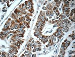 Thumbnail_C1orf56 Rabbit anti-Human, Mouse, Polyclonal, Proteintech:Antibodies:Primary