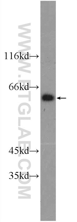 SCML4 Rabbit anti-Human, Mouse, Polyclonal, Proteintech 150 μL; Unconjugated:Antibodies,