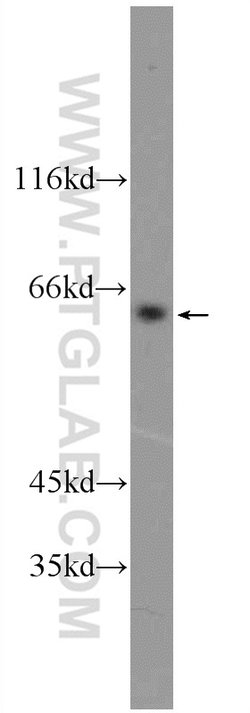 SCML4 Rabbit anti-Human, Mouse, Polyclonal, Proteintech 150 μL; Unconjugated:Antibodies,