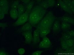 RRP36 Rabbit anti-Human, Polyclonal, Proteintech 150 μL; Unconjugated:Antibodies,