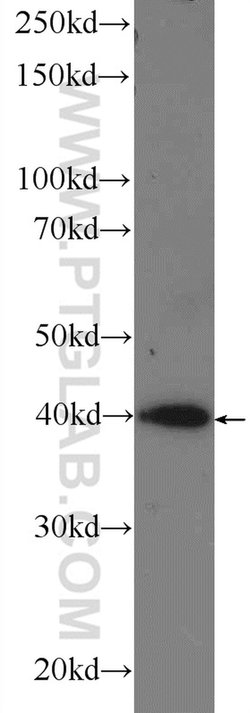 RRP36 Rabbit anti-Human, Polyclonal, Proteintech 150 μL; Unconjugated:Antibodies,