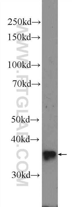 RRP36 Rabbit anti-Human, Polyclonal, Proteintech 150 μL; Unconjugated:Antibodies,