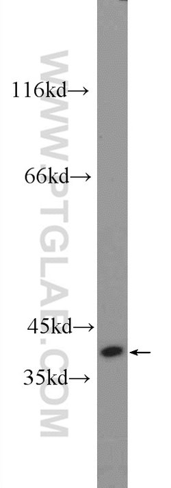 TTC35 Rabbit anti-Human, Mouse, Rat, Polyclonal, Proteintech:Antibodies:Primary