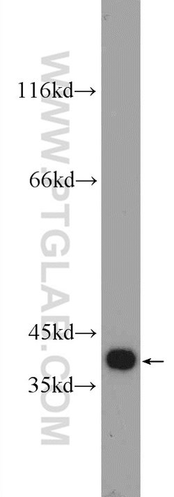 TTC35 Rabbit anti-Human, Mouse, Rat, Polyclonal, Proteintech:Antibodies:Primary
