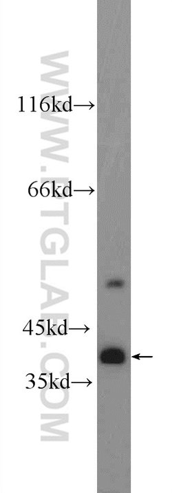 TTC35 Rabbit anti-Human, Mouse, Rat, Polyclonal, Proteintech:Antibodies:Primary