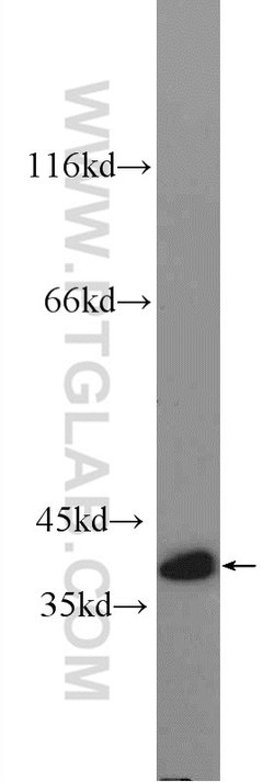 TTC35 Rabbit anti-Human, Mouse, Rat, Polyclonal, Proteintech:Antibodies:Primary