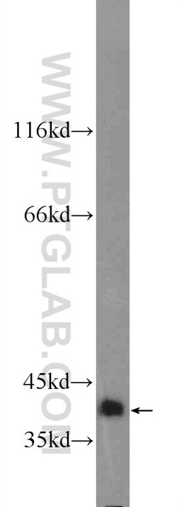 TTC35 Rabbit anti-Human, Mouse, Rat, Polyclonal, Proteintech:Antibodies:Primary
