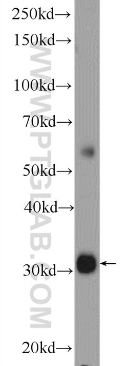 TTC35 Rabbit anti-Human, Mouse, Rat, Polyclonal, Proteintech:Antibodies:Primary