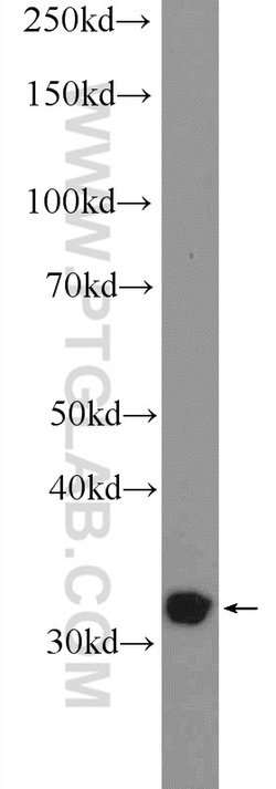 TTC35 Rabbit anti-Human, Mouse, Rat, Polyclonal, Proteintech:Antibodies:Primary
