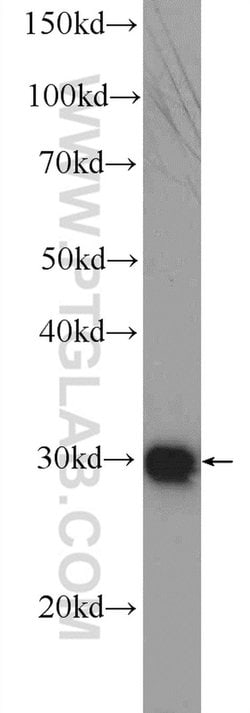 DNAJC9 Rabbit anti-Human, Polyclonal, Proteintech 150 &mu;L; Unconjugated:Antibodies,