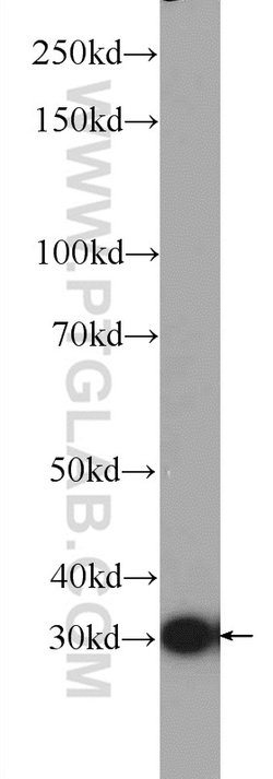 DNAJC9 Rabbit anti-Human, Polyclonal, Proteintech 150 &mu;L; Unconjugated:Antibodies,