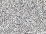 Thumbnail_TWIST1 Rabbit anti-Human, Mouse, Polyclonal, Proteintech 20 &mu;L; Unconjugated:Antibodies,