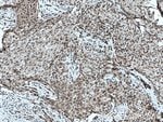 Thumbnail_TWIST1 Rabbit anti-Human, Mouse, Polyclonal, Proteintech 20 &mu;L; Unconjugated:Antibodies,