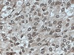 Thumbnail_TWIST1 Rabbit anti-Human, Mouse, Polyclonal, Proteintech 20 &mu;L; Unconjugated:Antibodies,