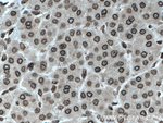 Thumbnail_TWIST1 Rabbit anti-Human, Mouse, Polyclonal, Proteintech 20 &mu;L; Unconjugated:Antibodies,