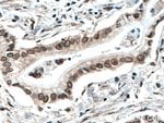 Thumbnail_TWIST1 Rabbit anti-Human, Mouse, Polyclonal, Proteintech 20 &mu;L; Unconjugated:Antibodies,