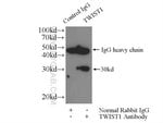 Thumbnail_TWIST1 Rabbit anti-Human, Mouse, Polyclonal, Proteintech 20 &mu;L; Unconjugated:Antibodies,