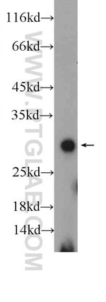 Thumbnail_TWIST1 Rabbit anti-Human, Mouse, Polyclonal, Proteintech 20 &mu;L; Unconjugated:Antibodies,