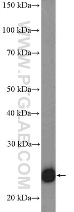 Thumbnail_TWIST1 Rabbit anti-Human, Mouse, Polyclonal, Proteintech 20 &mu;L; Unconjugated:Antibodies,