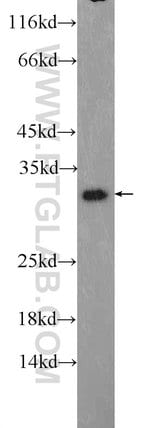 Thumbnail_TWIST1 Rabbit anti-Human, Mouse, Polyclonal, Proteintech 20 &mu;L; Unconjugated:Antibodies,