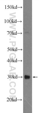 Thumbnail_TWIST1 Rabbit anti-Human, Mouse, Polyclonal, Proteintech 20 &mu;L; Unconjugated:Antibodies,