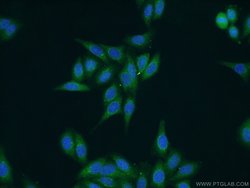 SAAL1 Rabbit anti-Human, Polyclonal, Proteintech 150 &mu;L; Unconjugated:Antibodies,