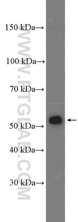 ACSF3 Rabbit anti-Human, Mouse, Polyclonal, Proteintech 150 &mu;L; Unconjugated:Antibodies,
