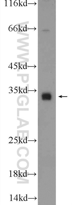 C18orf45 Rabbit anti-Human, Polyclonal, Proteintech 150 &mu;L | Buy Online | Proteintech Group Inc | Fisher Scientific