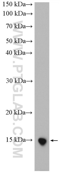 UCMA Rabbit anti-Human, Polyclonal, Proteintech 150 μL; Unconjugated:Antibodies,