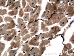 TMEM102 Rabbit anti-Human, Mouse, Polyclonal, Proteintech 20 &mu;L; Unconjugated:Antibodies,