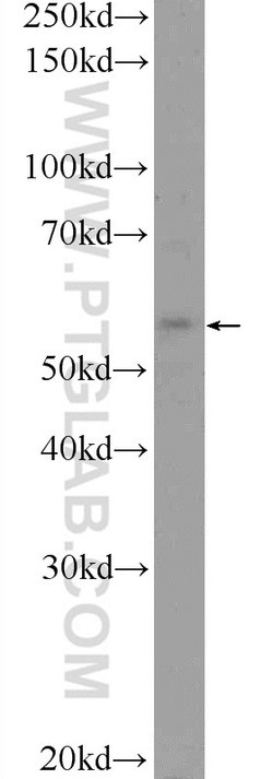 TMEM102 Rabbit anti-Human, Mouse, Polyclonal, Proteintech 20 &mu;L; Unconjugated:Antibodies,