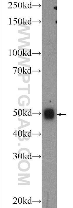 TMEM102 Rabbit anti-Human, Mouse, Polyclonal, Proteintech 20 &mu;L; Unconjugated:Antibodies,