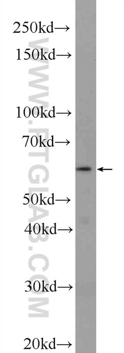 TMEM102 Rabbit anti-Human, Mouse, Polyclonal, Proteintech 20 &mu;L; Unconjugated:Antibodies,