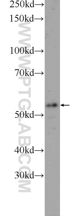 TMEM102 Rabbit anti-Human, Mouse, Polyclonal, Proteintech 20 &mu;L; Unconjugated:Antibodies,