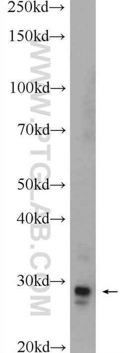 MPZL3 Rabbit anti-Human, Mouse, Polyclonal, Proteintech 150 &mu;L; Unconjugated:Antibodies,