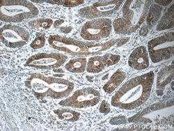 NPB Rabbit anti-Human, Polyclonal, Proteintech 150 &mu;L; Unconjugated:Antibodies,