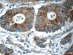 NPB Rabbit anti-Human, Polyclonal, Proteintech 150 &mu;L; Unconjugated:Antibodies,
