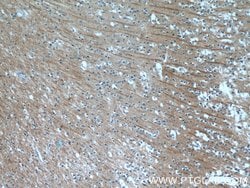 NPB Rabbit anti-Human, Polyclonal, Proteintech 150 &mu;L; Unconjugated:Antibodies,