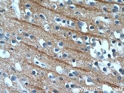 NPB Rabbit anti-Human, Polyclonal, Proteintech 150 &mu;L; Unconjugated:Antibodies,
