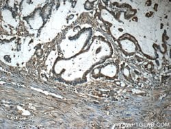TAF15 Rabbit anti-Human, Mouse, Polyclonal, Proteintech 150 &mu;L; Unconjugated:Antibodies,