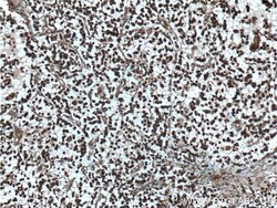 beta Amyloid (C-Terminal) Rabbit anti-Human, Mouse, Polyclonal, Proteintech 20 &mu;L | Buy Online | Proteintech | Fisher Scientific