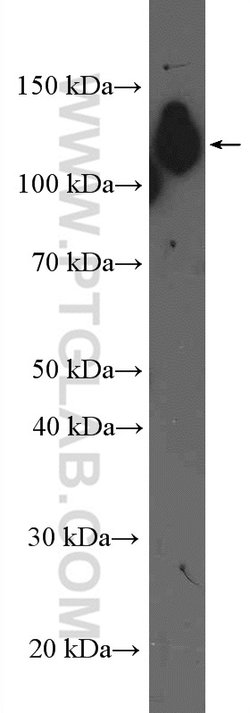 beta Amyloid (C-Terminal) Rabbit anti-Human, Mouse, Polyclonal, Proteintech 20 &mu;L | Buy Online | Proteintech | Fisher Scientific
