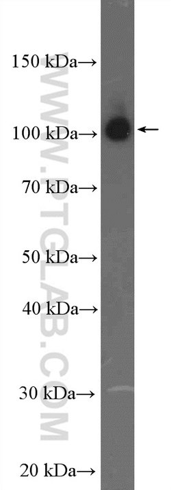 beta Amyloid (C-Terminal) Rabbit anti-Human, Mouse, Polyclonal, Proteintech 20 &mu;L | Buy Online | Proteintech | Fisher Scientific