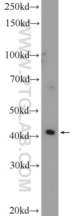 SLC35F2 Rabbit anti-Human, Mouse, Polyclonal, Proteintech 150 &mu;L | Buy Online | Proteintech Group Inc | Fisher Scientific