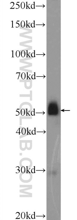 SLC35F2 Rabbit anti-Human, Mouse, Polyclonal, Proteintech 150 &mu;L | Buy Online | Proteintech Group Inc | Fisher Scientific