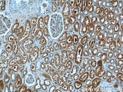 PGBD1 Rabbit anti-Human, Mouse, Polyclonal, Proteintech:Antibodies:Primary