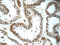 PGBD1 Rabbit anti-Human, Mouse, Polyclonal, Proteintech:Antibodies:Primary