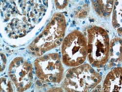 PGBD1 Rabbit anti-Human, Mouse, Polyclonal, Proteintech:Antibodies:Primary
