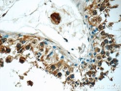 PGBD1 Rabbit anti-Human, Mouse, Polyclonal, Proteintech:Antibodies:Primary